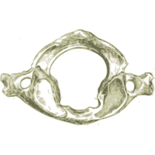 Cervical vertebra