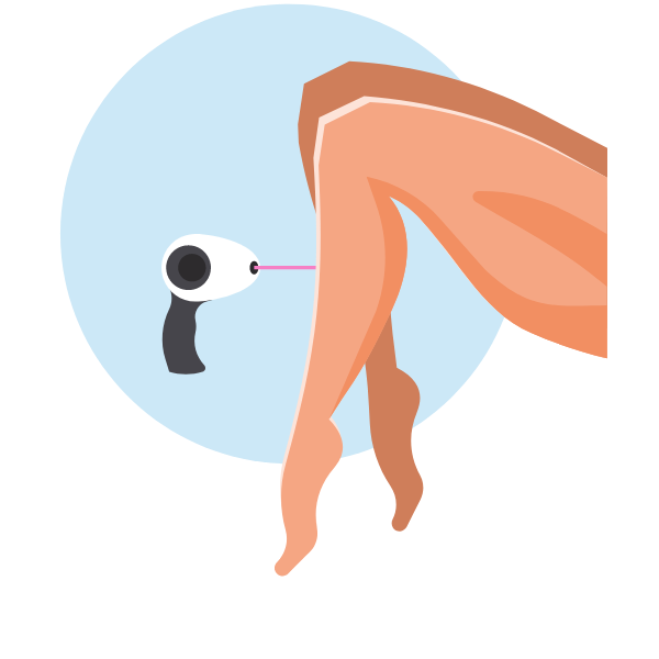 Leg depilation