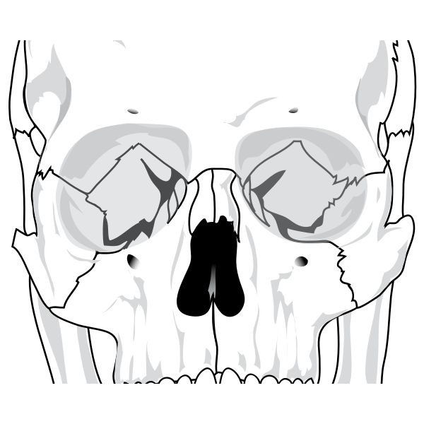 Human skull