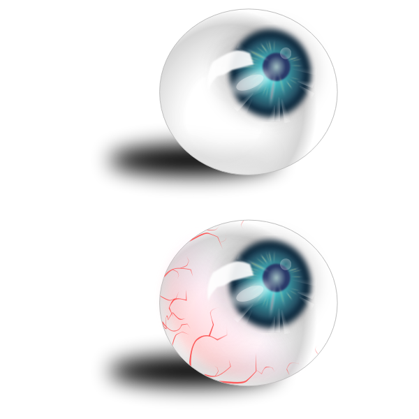 Two eyeballs